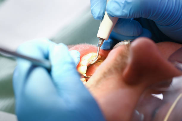 Best Tooth Infection Emergency Dentist  in Blackville, SC