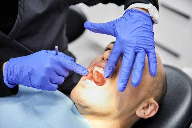Best Knocked-Out Tooth Emergency  in Blackville, SC